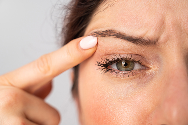 Eyelid Surgery Procedure Fort Myers
